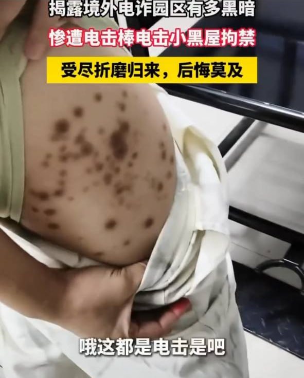 回国狗推在展示。园区光辉岁月 ,以及自己打下的江山。此刻后悔莫及了。