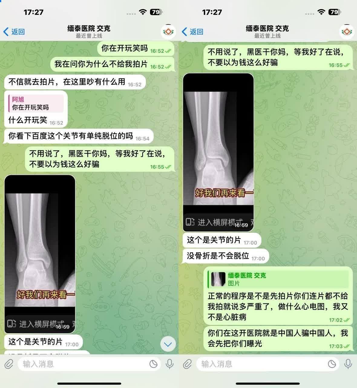 网友爆料 缅甸 交克医院