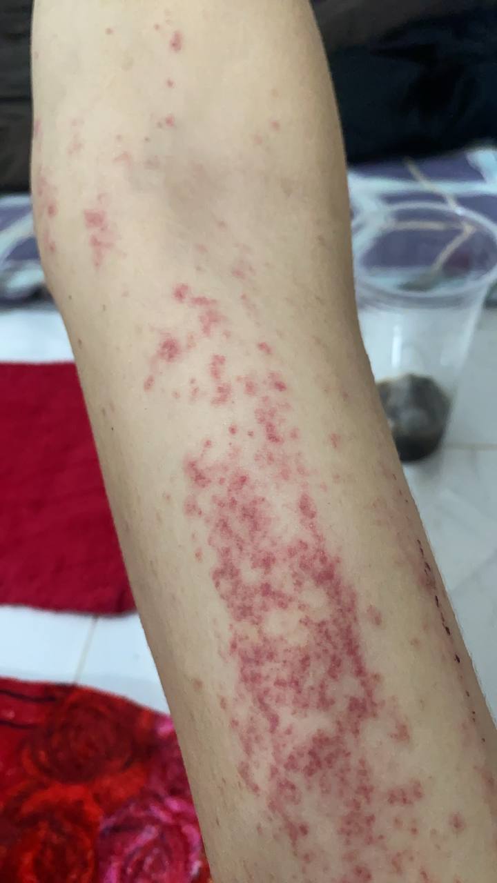 群友投稿:柬埔寨第三安置点,根本没有把我们当成人对待